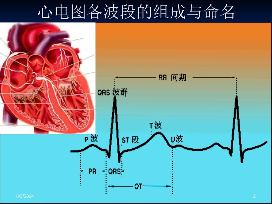 临床医学异常心电图的诊断_第2页