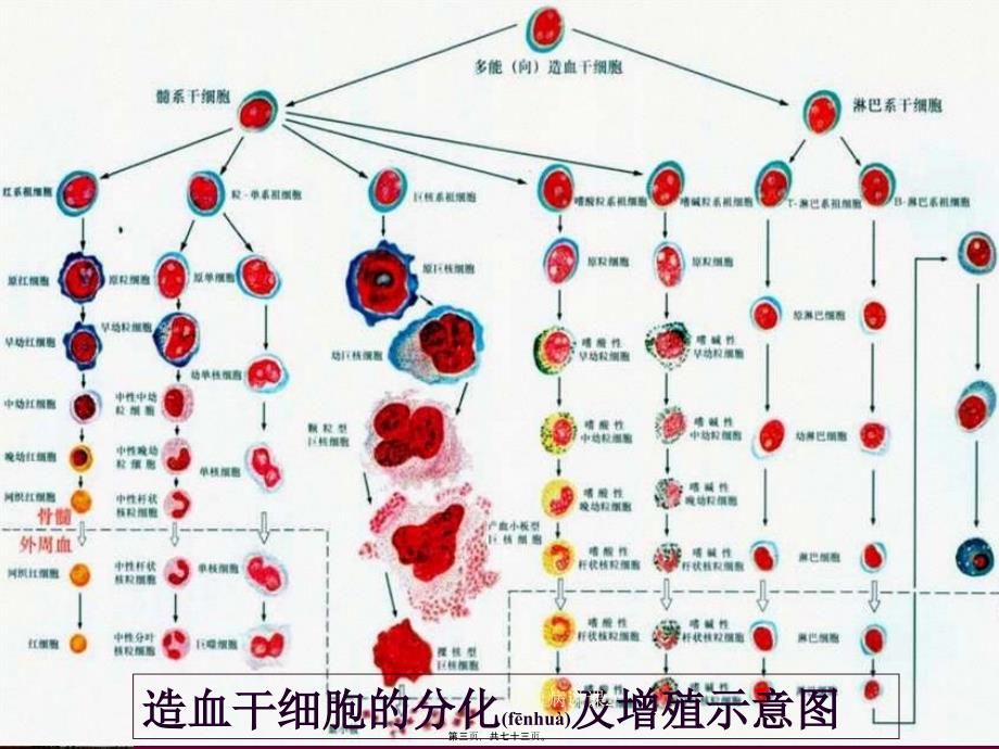 白血病讲课2课件_第3页