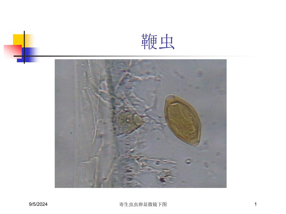 寄生虫虫卵显微镜下图课件_第1页