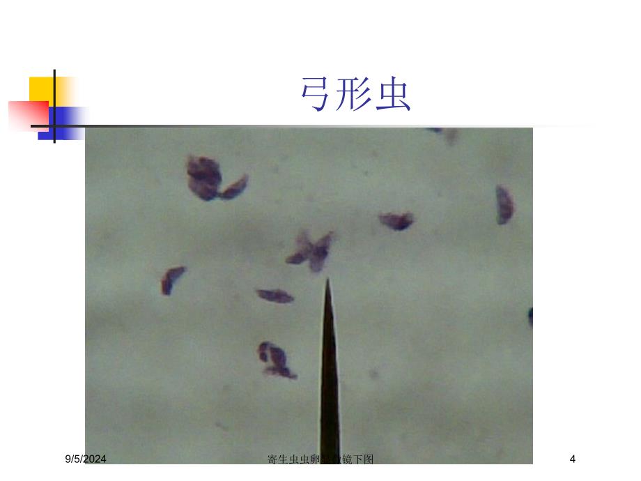 寄生虫虫卵显微镜下图课件_第4页