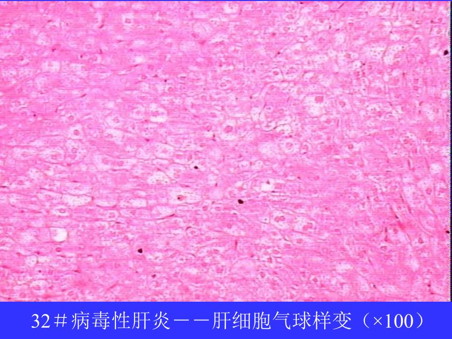 实验九消化系统疾病和消化系统肿瘤文档资料_第4页