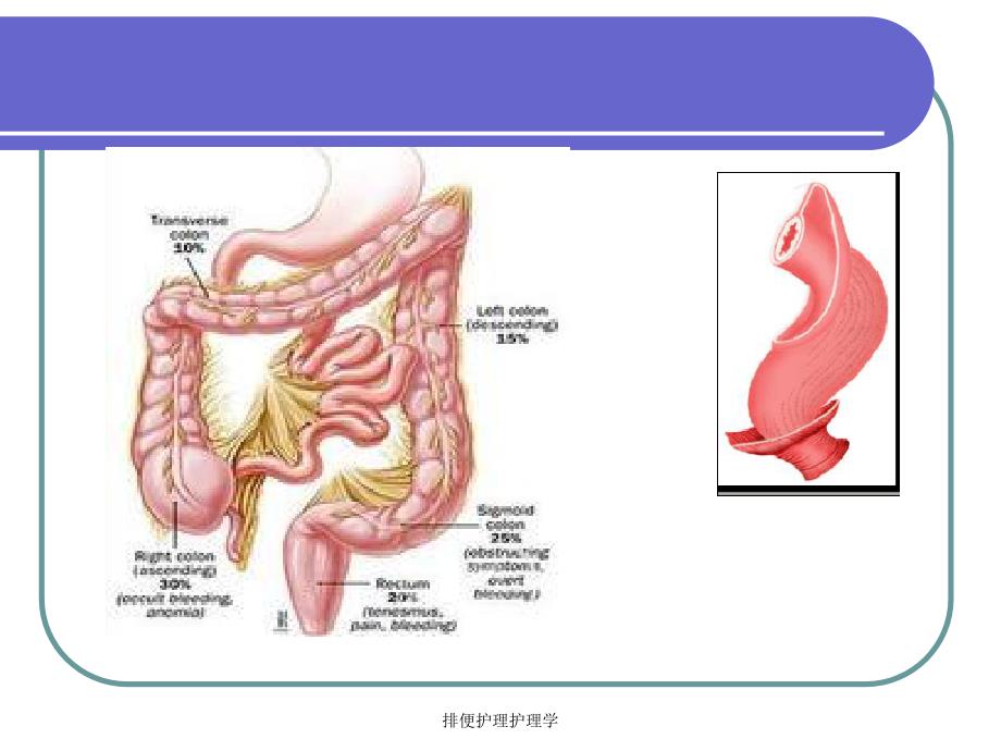 排便护理护理学课件_第4页