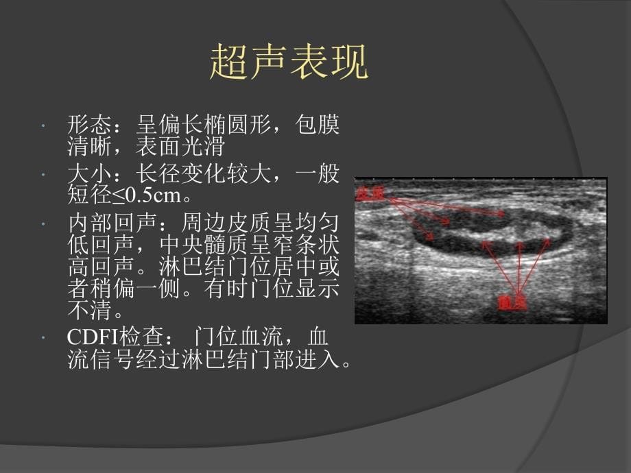 慢性淋巴结炎症精选文档_第5页