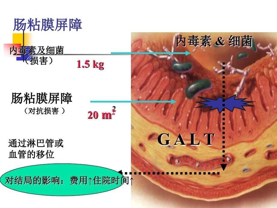 脑外伤病人的营养支持课件_第5页