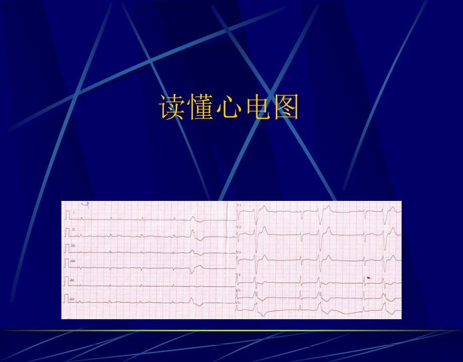 读懂心电PPT课件_第1页