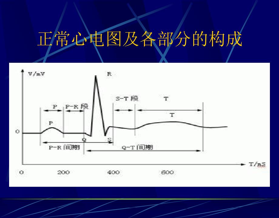 读懂心电PPT课件_第4页