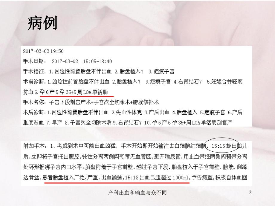 产科出血和输血与众不同课件_第2页