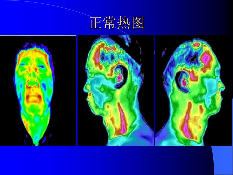 红外热成像三种热图.ppt_第2页