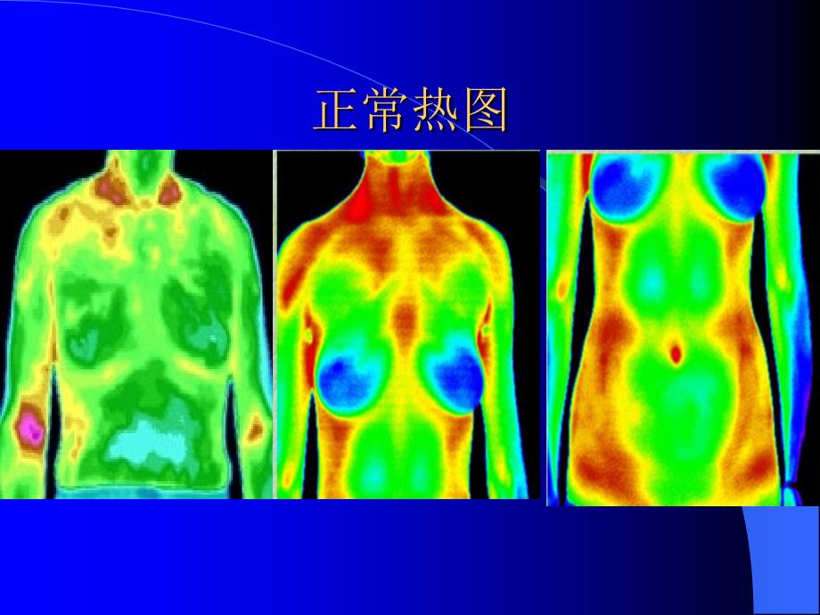 红外热成像三种热图.ppt_第3页