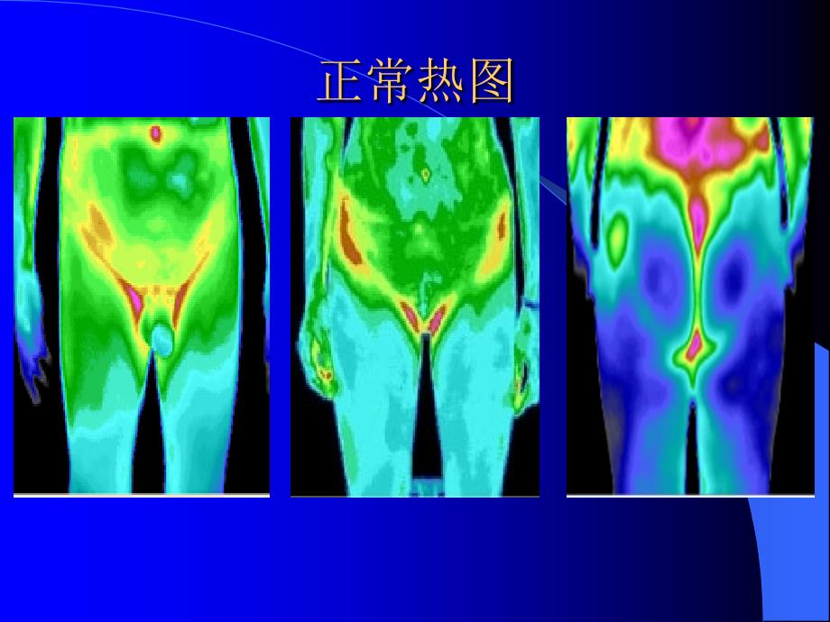 红外热成像三种热图.ppt_第4页