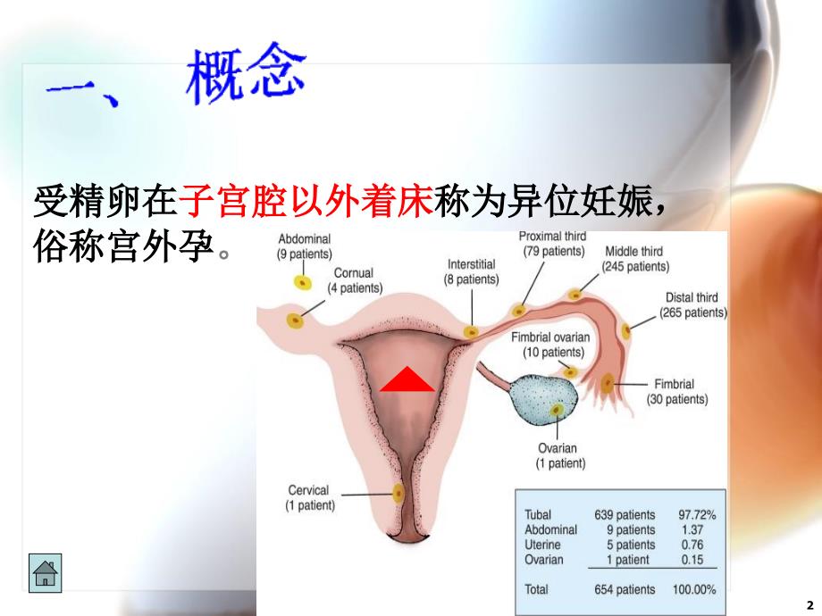 宫外孕图文并茂_第2页