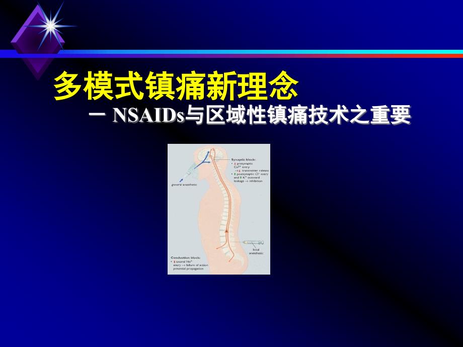 医学专题：多模式镇痛新理念_第1页