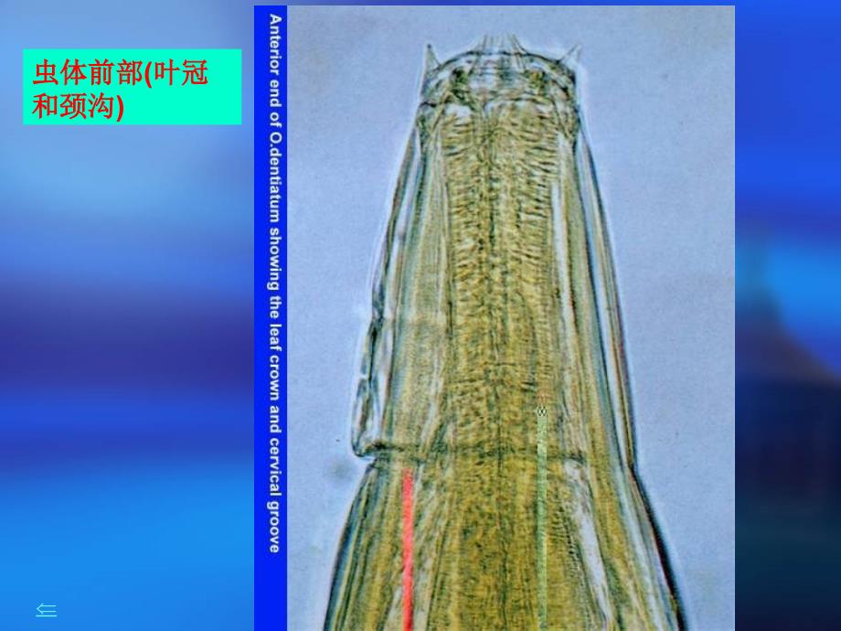 牛羊食道口线病_第3页