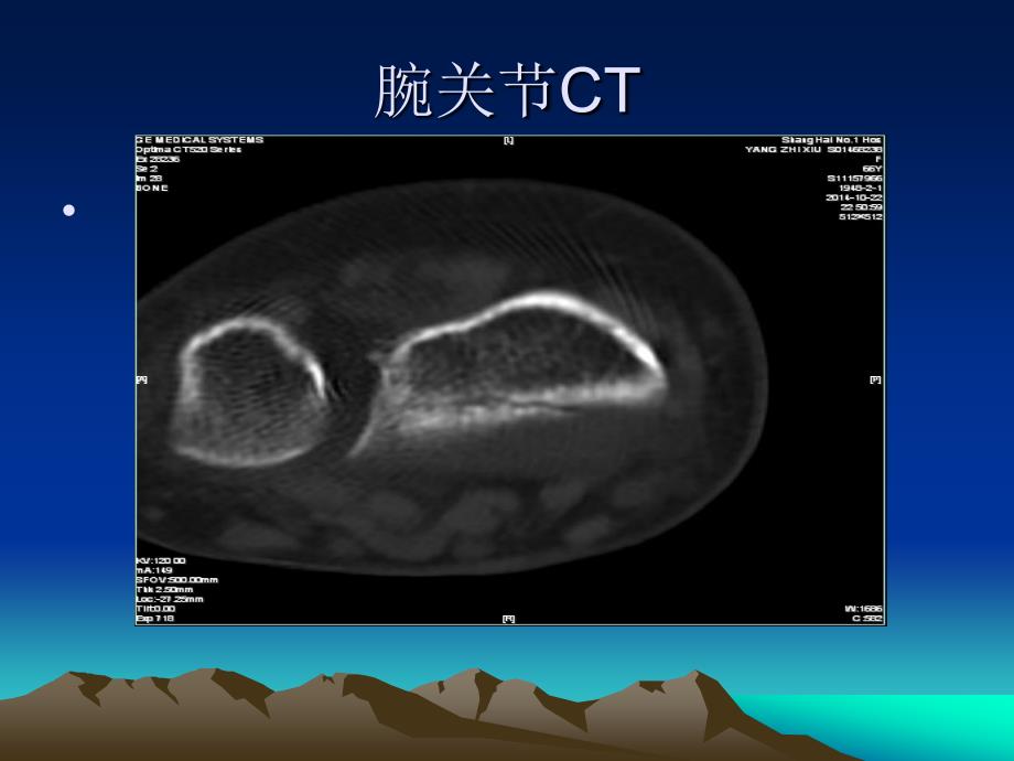 容易遗漏骨折.整理_第3页