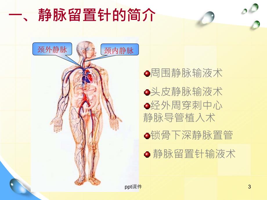 静脉留置针并发症及护理小讲课ppt课件_第3页