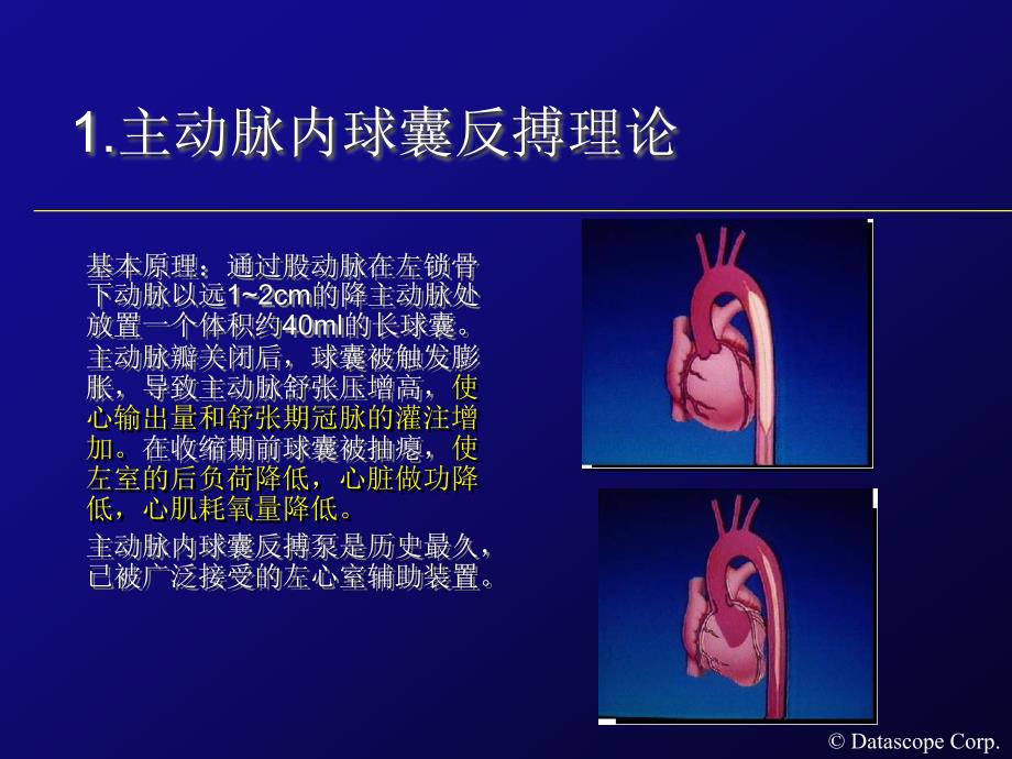 IABP的临床使用_第2页