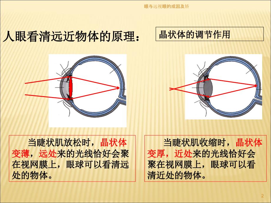 眼与远视眼的成因及矫课件_第2页