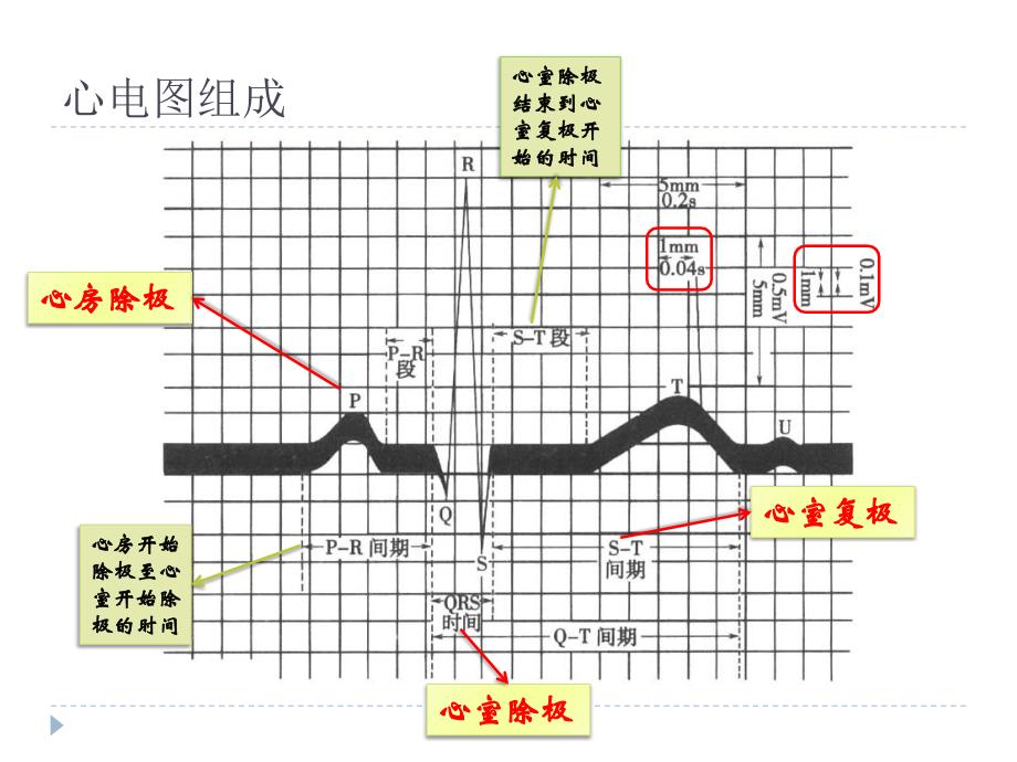 icu常见心律失常课件_第3页