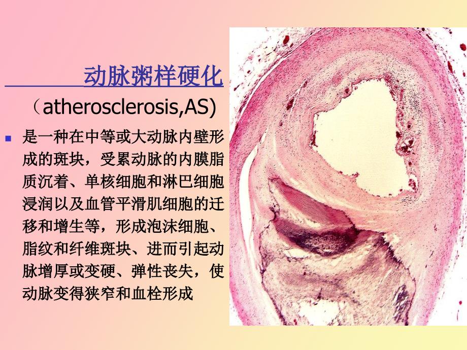 调血脂和抗动脉粥样硬化药物_第3页