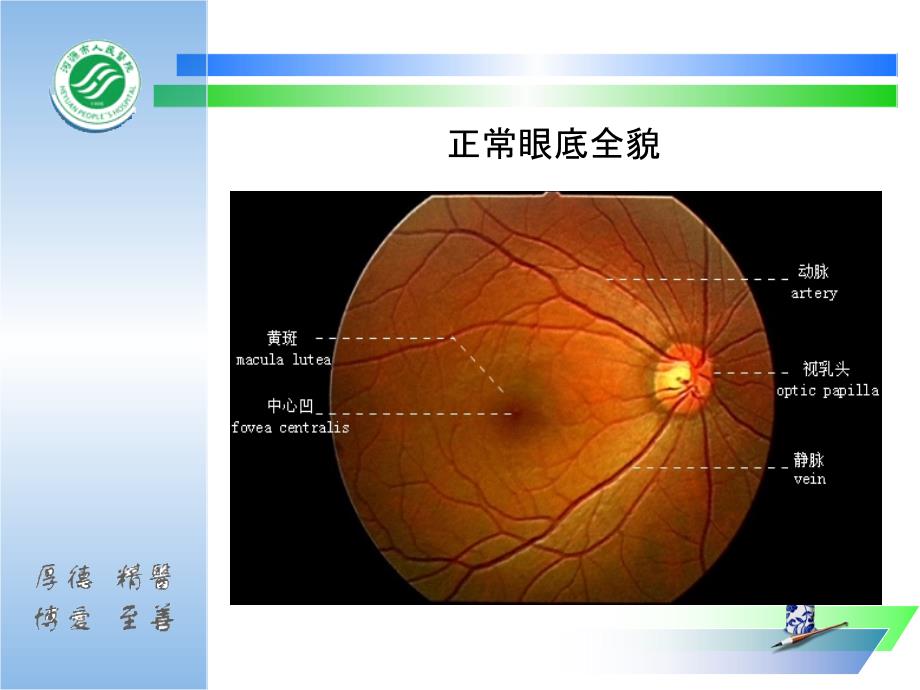 《眼底病与全身病》PPT课件_第4页