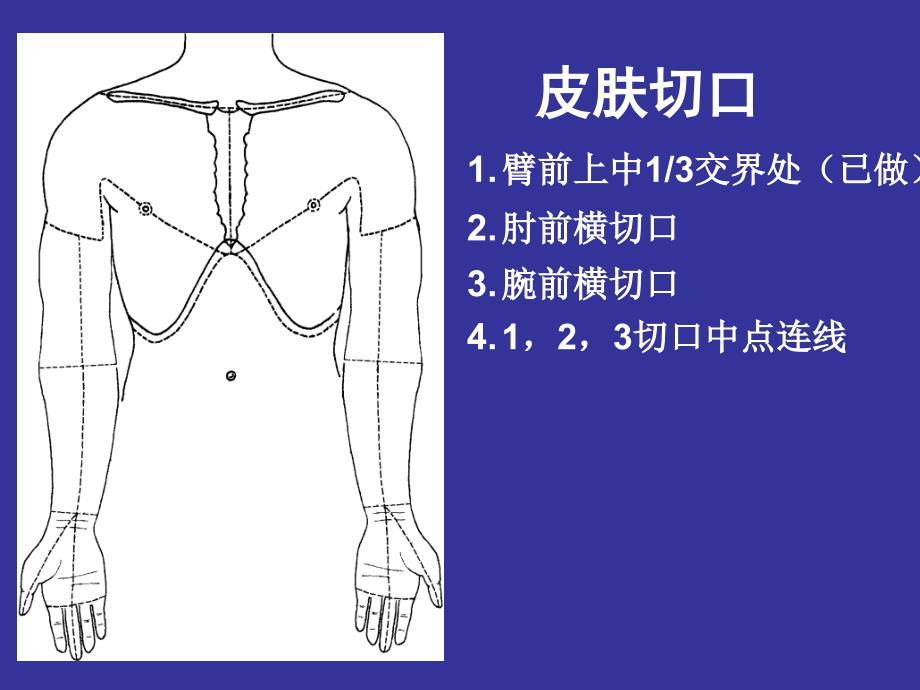 3上肢前区颈前区腹前外侧壁_第4页