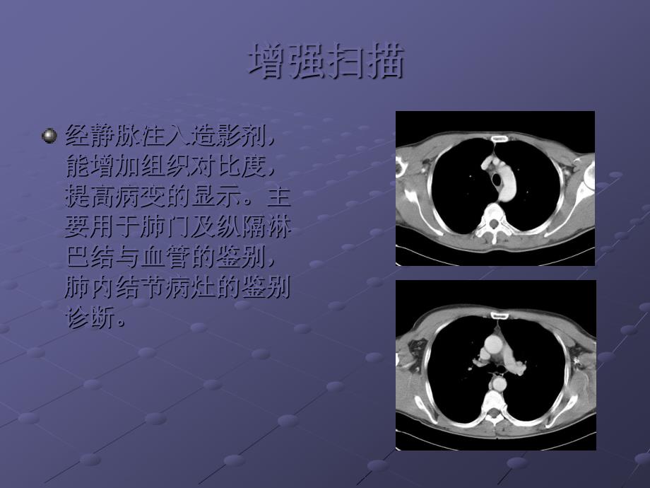 胸部CT基础知识ppt课件_第4页