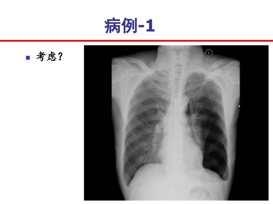 危重症患儿的早期识别_第3页