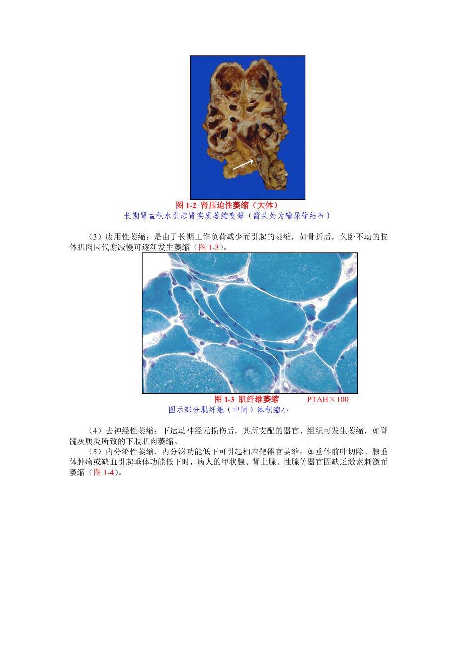 第一章细胞和组织的适应损伤与修复_第2页