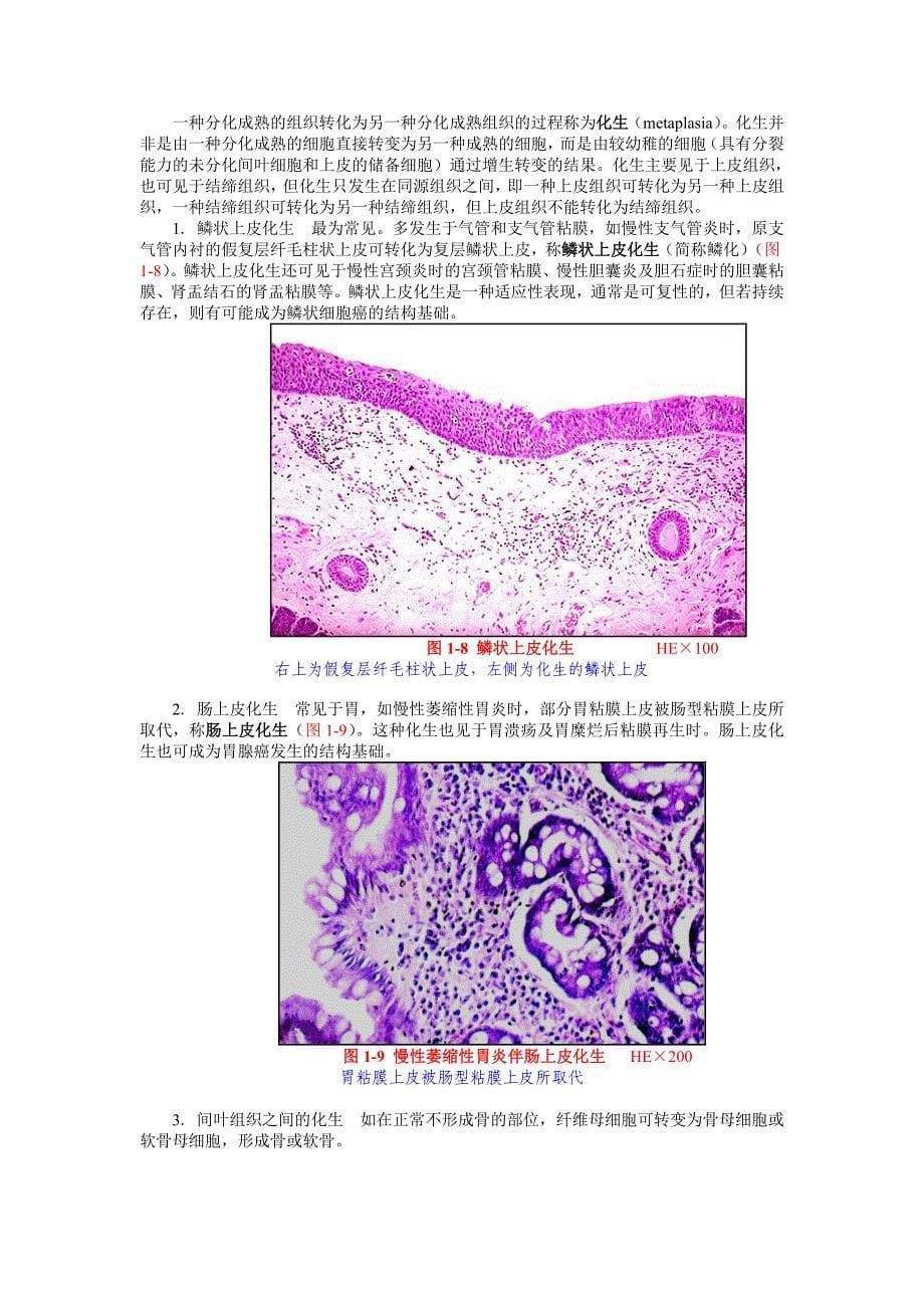 第一章细胞和组织的适应损伤与修复_第5页