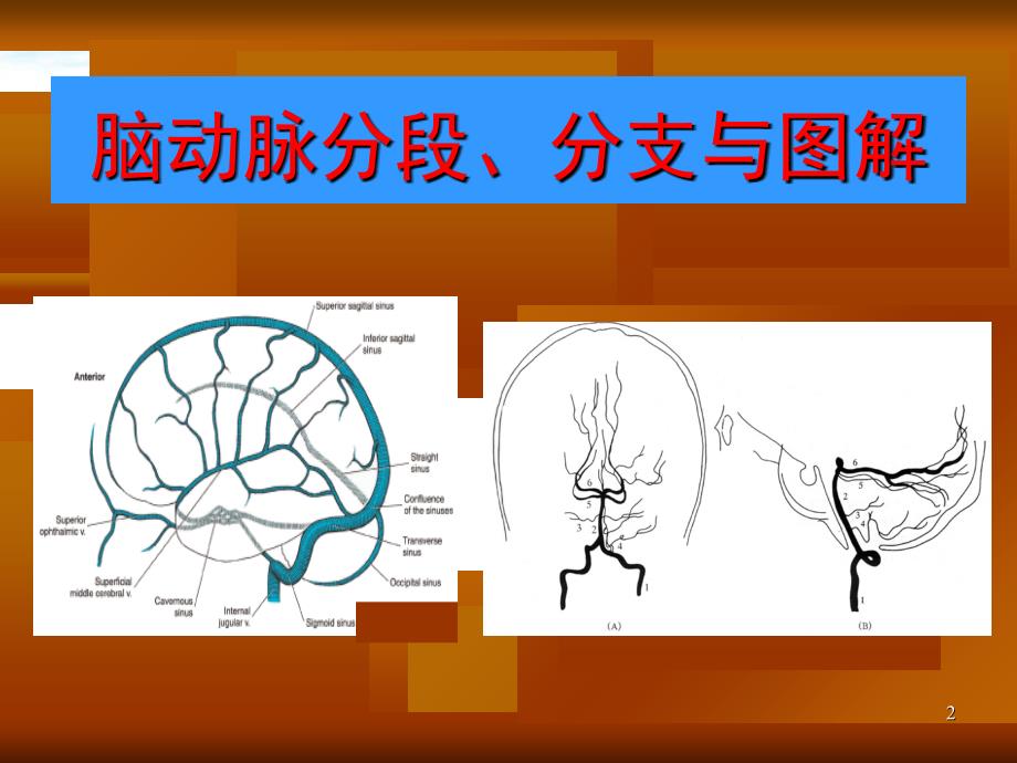 脑血管解剖图解共34页_第2页