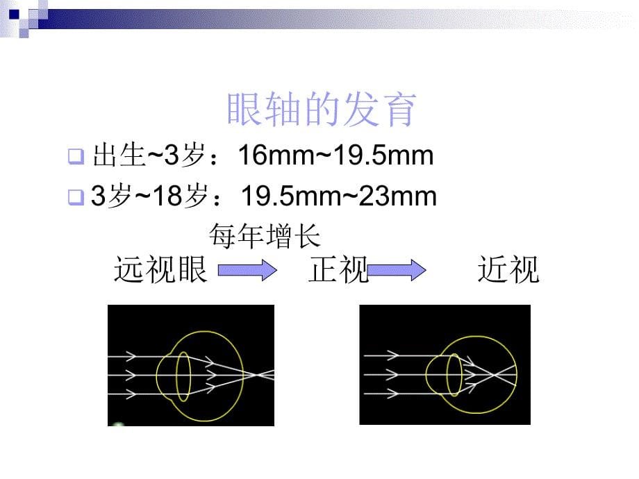 爱眼知识科普基础讲座课件_第5页