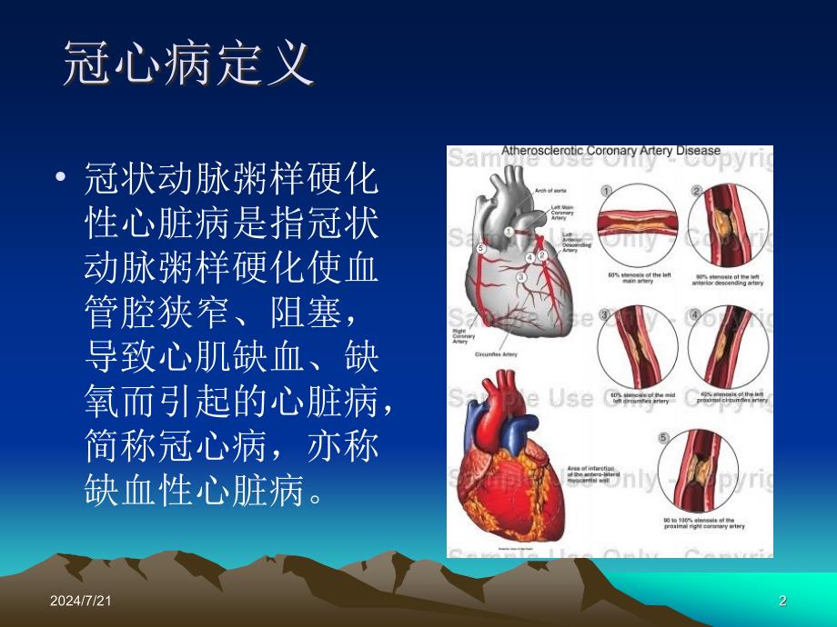 冠心病病例讨论ppt参考课件_第2页