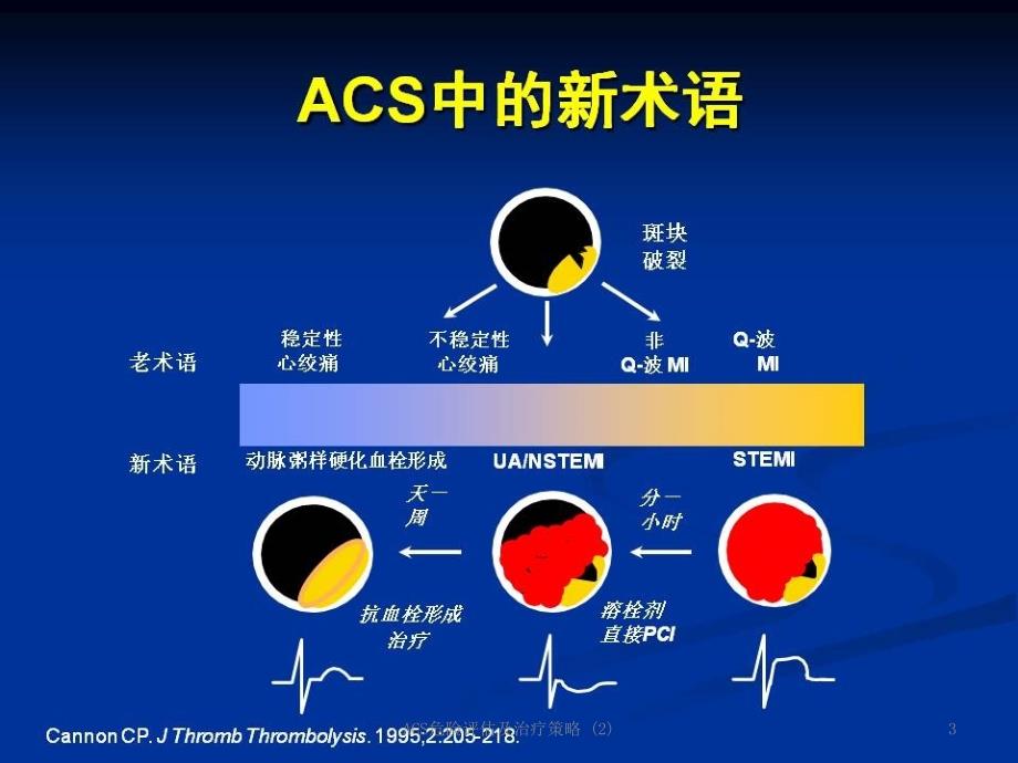 ACS危险评估及治疗策略2课件_第3页