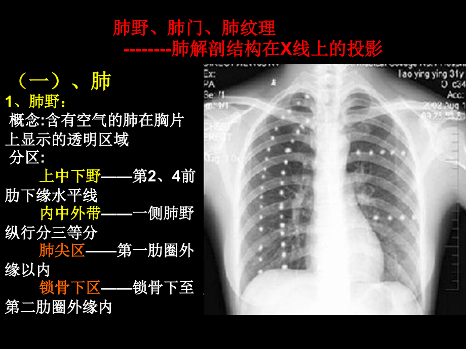 技能1：呼吸系统疾病X线诊断_第4页