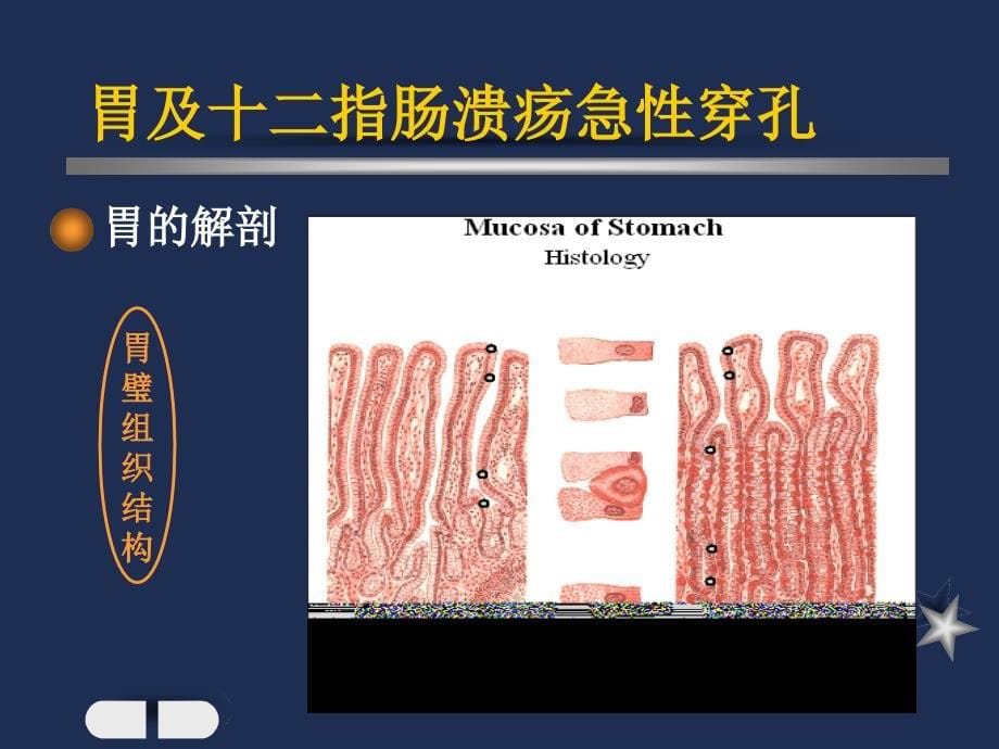 胃及十二指肠溃疡急性穿孔_第5页