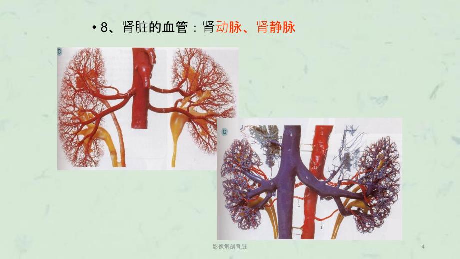 影像解剖肾脏课件_第4页