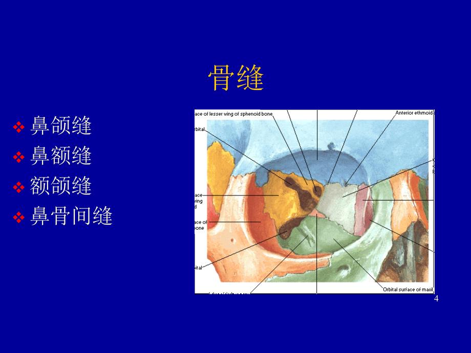 鼻骨骨折影像学诊断课件_第4页