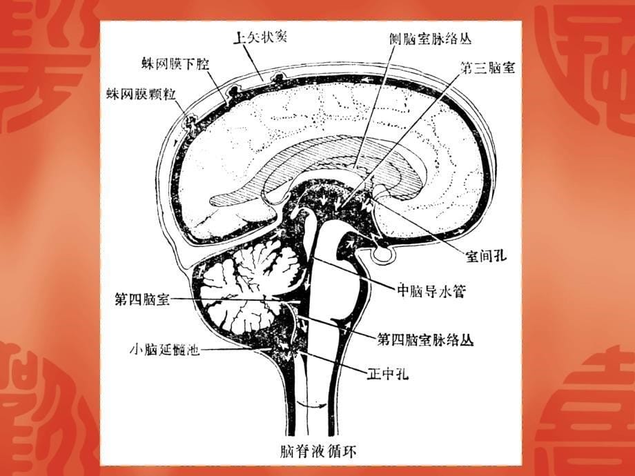 腰椎术后脑脊液漏的观察和护理_第5页