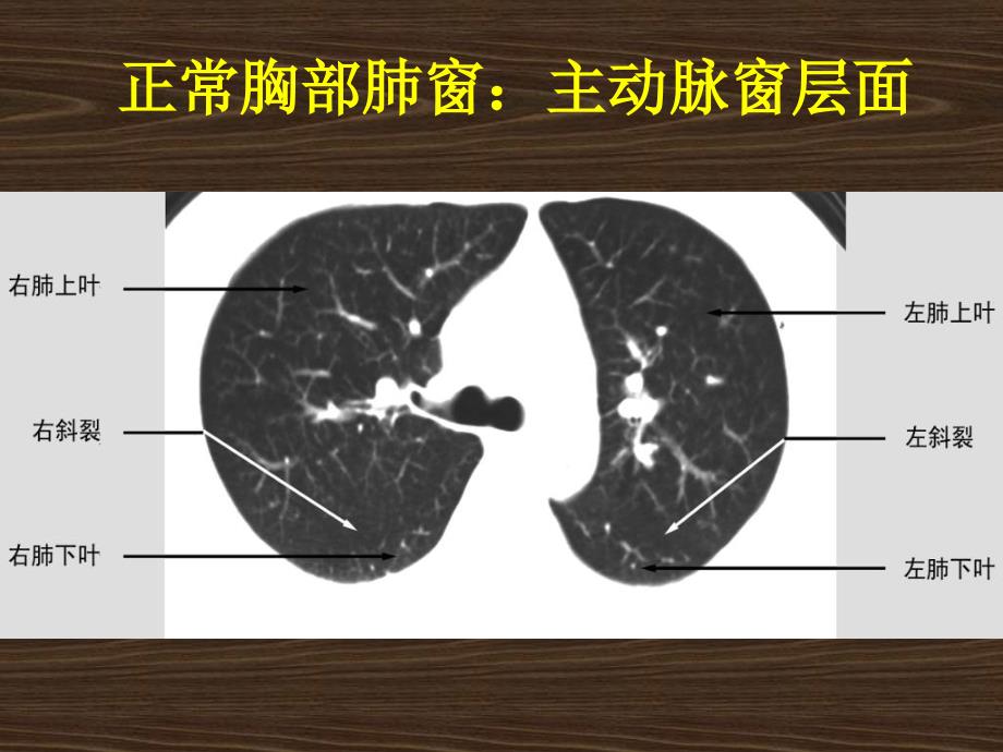 内科学课件临床应用_第4页