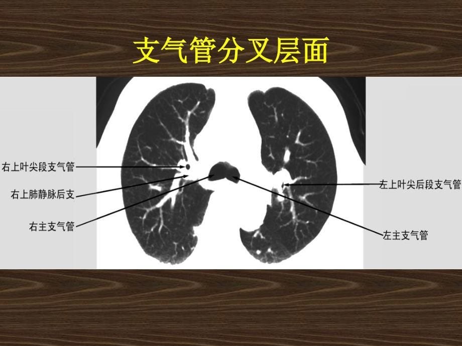 内科学课件临床应用_第5页