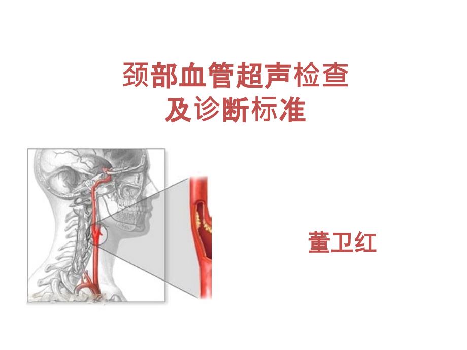 颈部血管超声检查及诊断标准41861_第1页