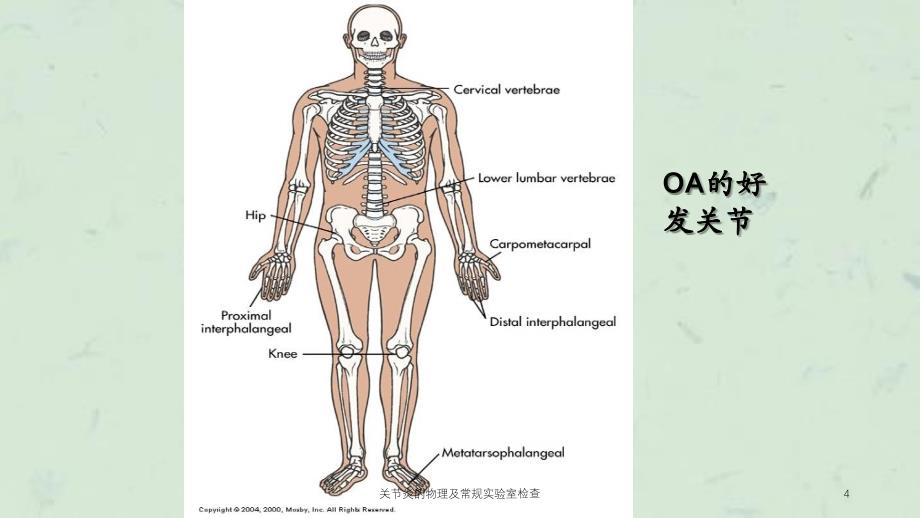 关节炎的物理及常规实验室检查课件_第4页