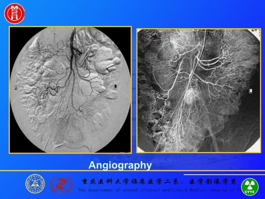 食管与胃肠道的影像诊断重医医学影像学课件_第5页