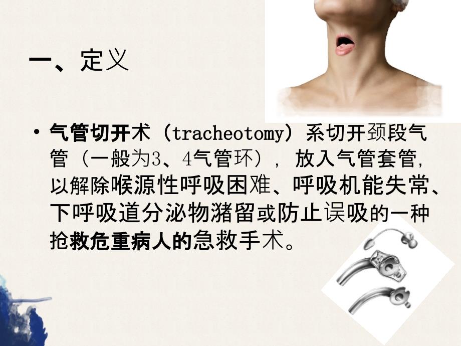 气管切开术Tracheotomy_第3页