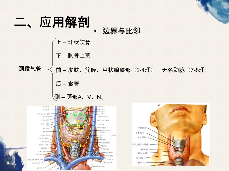 气管切开术Tracheotomy_第4页