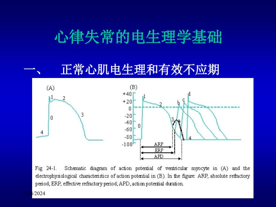 [医学]抗心律失常药课件_第3页