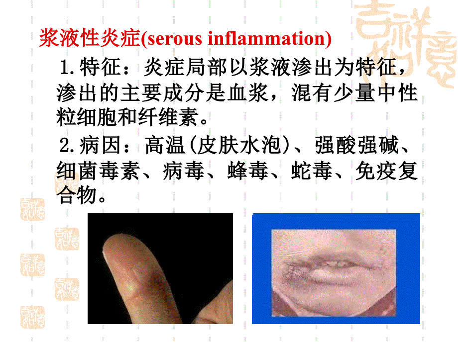 3实验三炎症文档资料_第3页