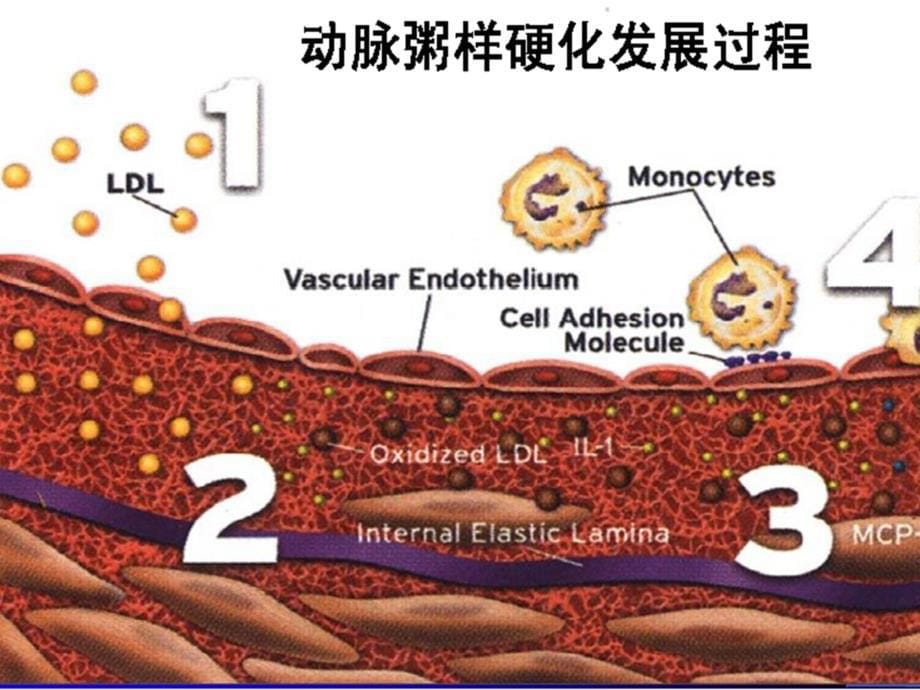 他汀和贝特类药物联合应用的基础与前景_第5页