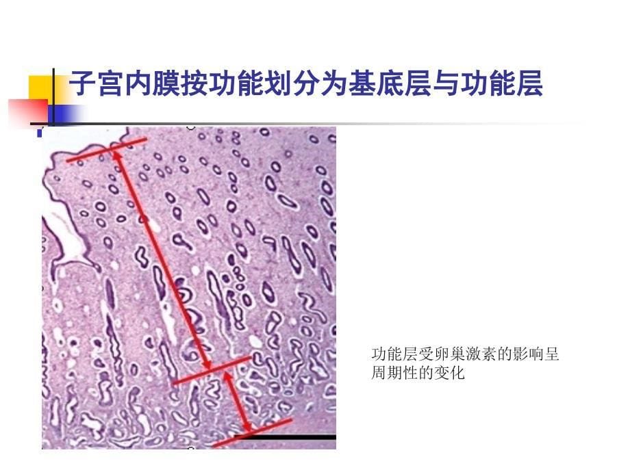 超声检测卵泡发育课件_第5页