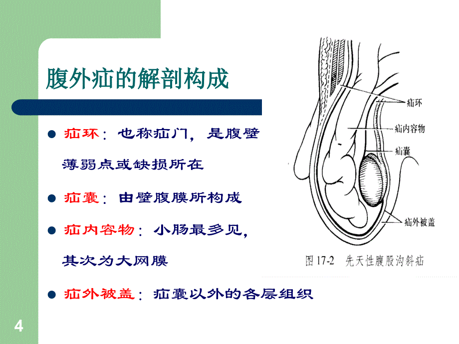 腹外疝围手术期的护理ppt课件_第4页